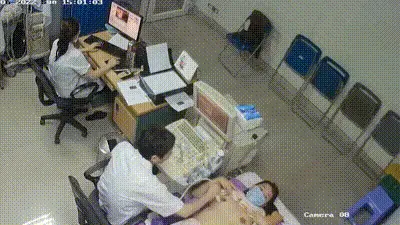 医院b超室监控偷拍 动图预览